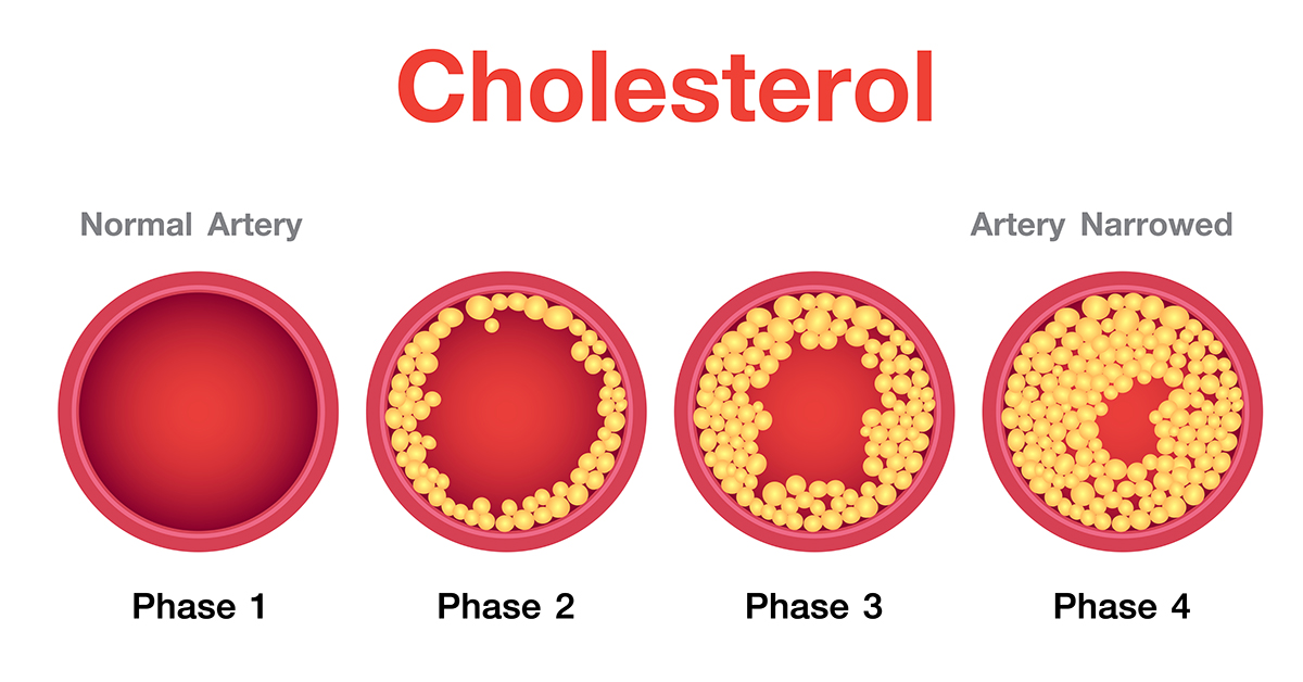 cholesterol phases